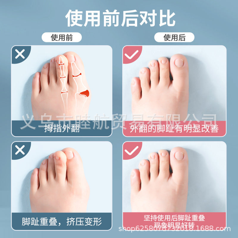 Toe Seperators