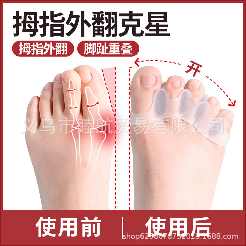 Toe Seperators